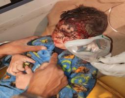 انقاذ الطفل حسين علي عامر حيا من مجزرة النبطية !